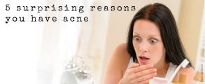 5 surprising reasons you have acne